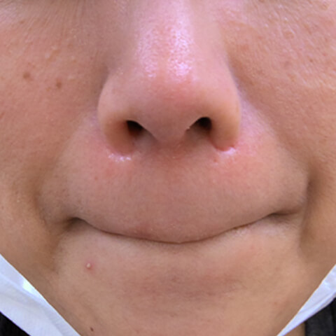 AFTER